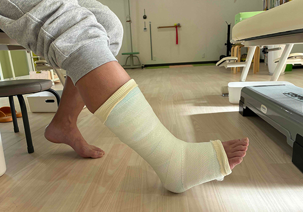 治療ギプス
